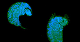 Личинка наїзника-іхневмоніда, яка паразитує на лялечці дрозофіли