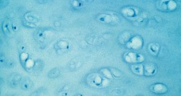 Хрящова тканина