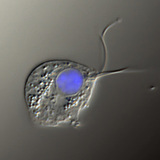 Збудник вагінальної трихомонади (диференціальне інтерференційно-контрастне зображення, ядро клітини забарвлене в синій колір)