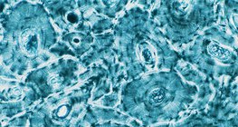 Кісткова тканина