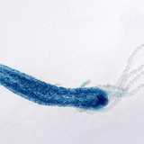 Freshwater hydra (stained)