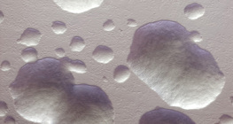 Колонії кишечної палочки (без барвника, білі)