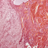 Гіпофіз (поздовжній розріз, мале збільшення)