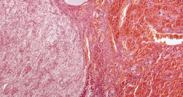 Гіпофіз (поздовжній розріз, мале збільшення)