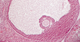 Поперечний розріз яєчника (ссавця)