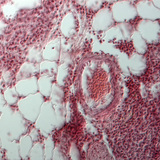 Легеня людини в розрізі