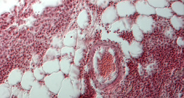 Легеня людини в розрізі