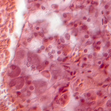 Зріз гіпофіза