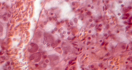 Зріз гіпофіза