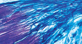 Зв'язок між м'язовою тканиною і тканиною сухожилля