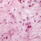 Зріз гіпофіза