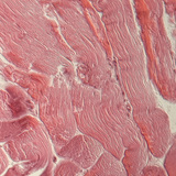 Сухожилля (поперечний переріз)