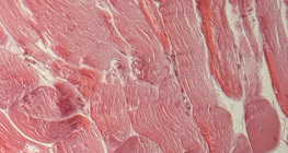 Сухожилля (поперечний переріз)