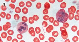 Тканина крові