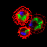 Кров'яні клітини дрозофіли (червоні) і захоплені ними бактерії (зеленого кольору)