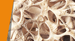 Слабкі кістки