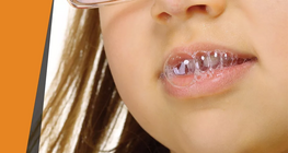 "Їдка" слина