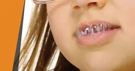 "Їдка" слина