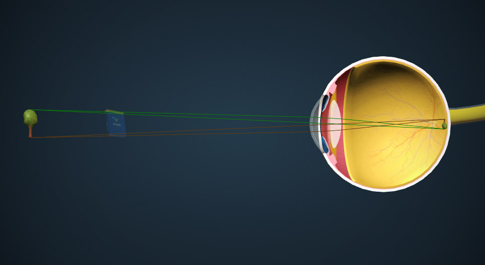 The mechanism of vision